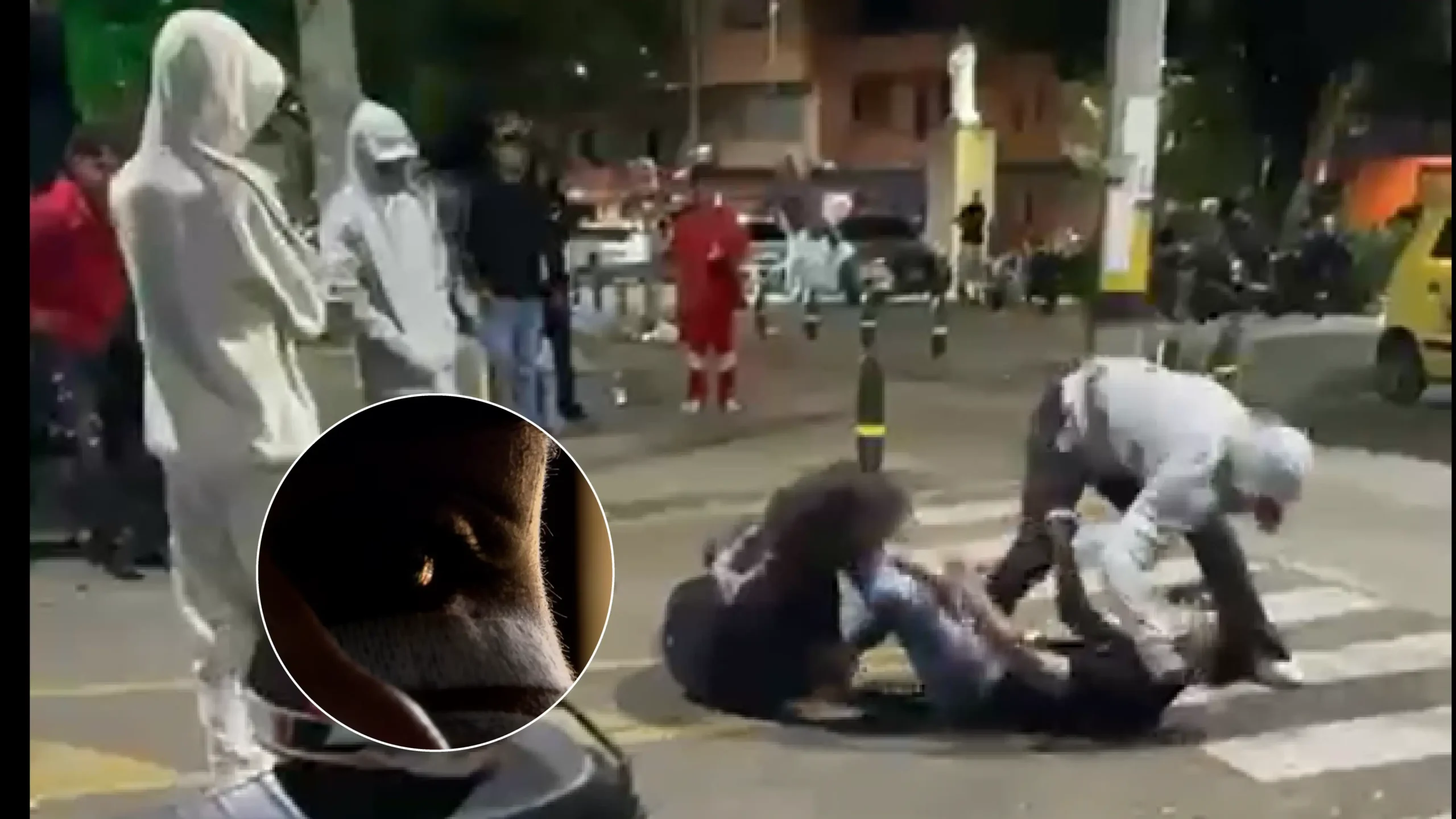 Fuerte golpiza a joven en Envigado: por mediar en una discusión terminó con varias cirugía